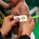 WHO-UAE Alliance Battles Child Malnutrition in Yemen’s Socotra