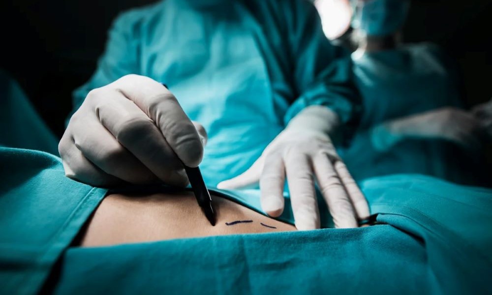 Unpacking Rwanda’s new health law