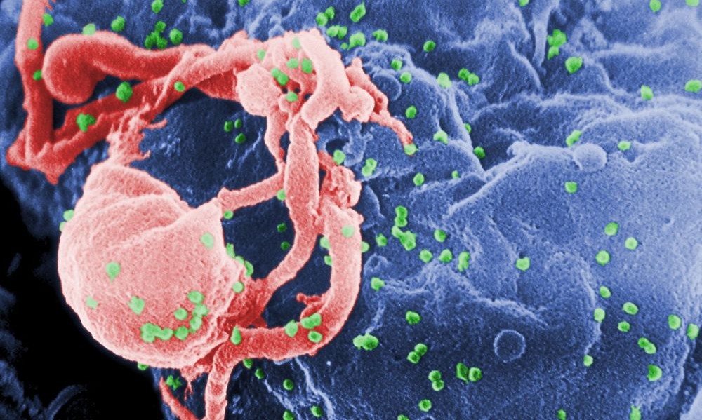 The Berlin case challenging HIV dogma